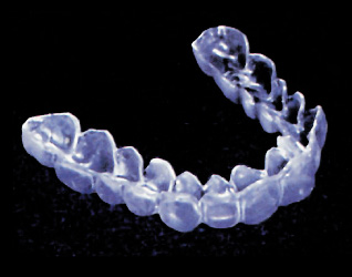 Die Okklusionsschiene